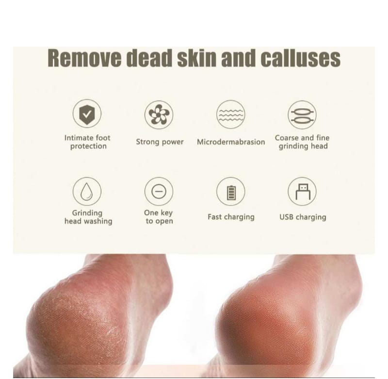 Rechargeable Electric foot callus remover